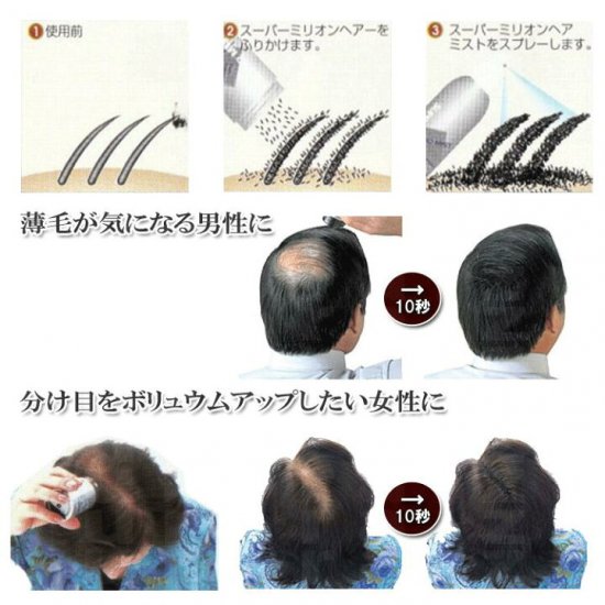 ルアン スーパーミリオンヘアー Cmでおなじみ